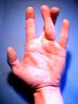 Hand